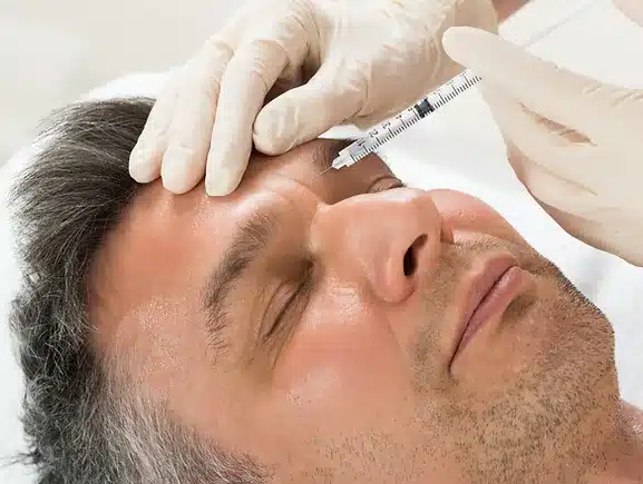 photo of maan getting botox injected into his forhead in san diego, ca